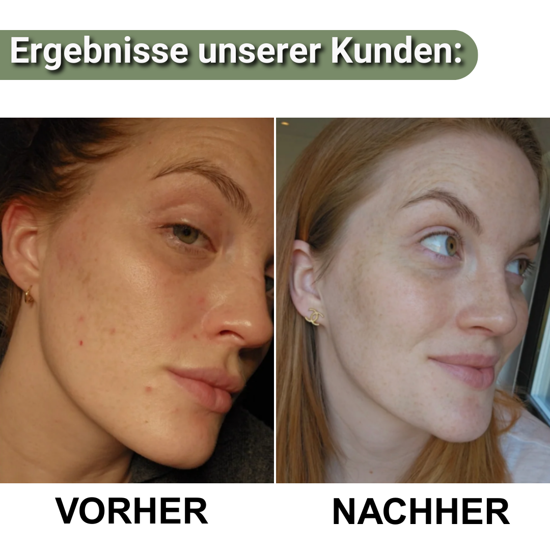 LioraGlanz Reis Peeling – Das perfekte Haut-Set für sichtbar glattere, strahlendere Haut